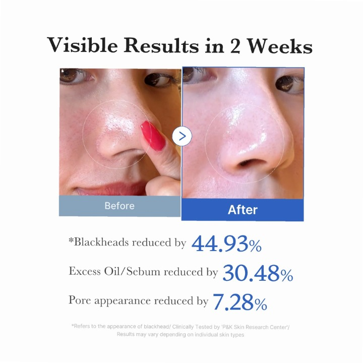 Zero Pore Pad 2.0 Original